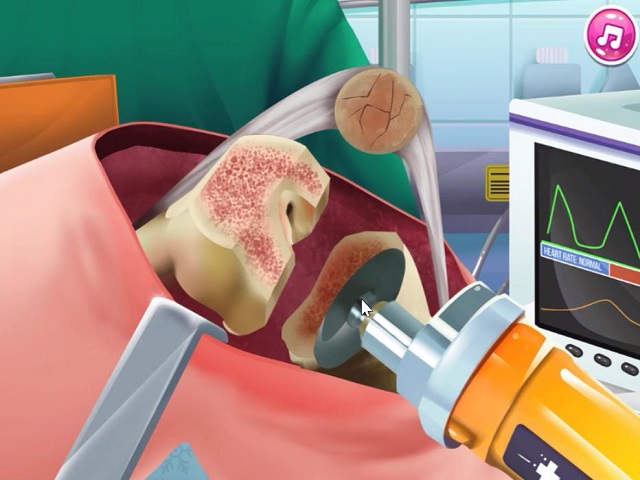 KNEE SURGERY SIMULATOR jogo online no JogosJogos.com